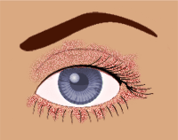 Blepharitis can appear as greasy flakes or scales around the base of the eyelashes.
